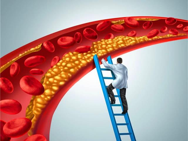 血脂高，到底是“降”好，還是“調(diào)”好？
